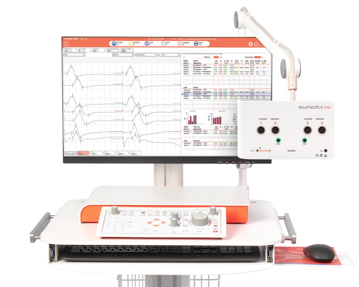 Elektroneuromiyografiya (ENMG)
